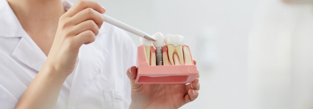 ¿Qué consecuencias funcionales y estéticas conlleva la falta de dientes?