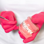 implantes dentales y ortodoncia